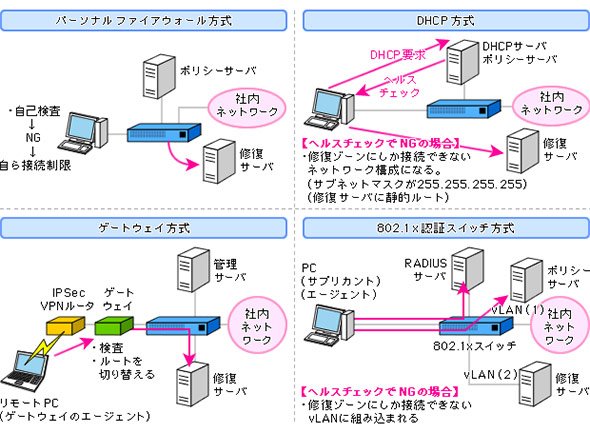 検疫ネットワークの4つの方式