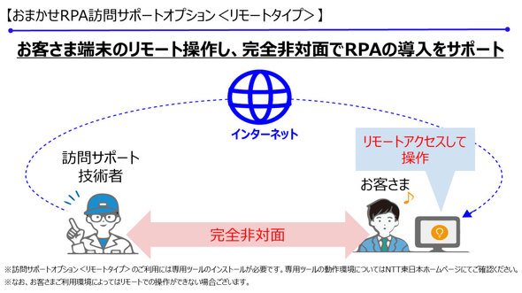 リモートタイプ